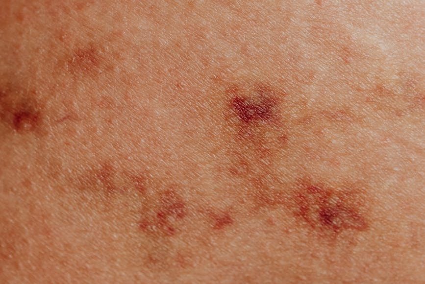 close up of a skin with a disorder