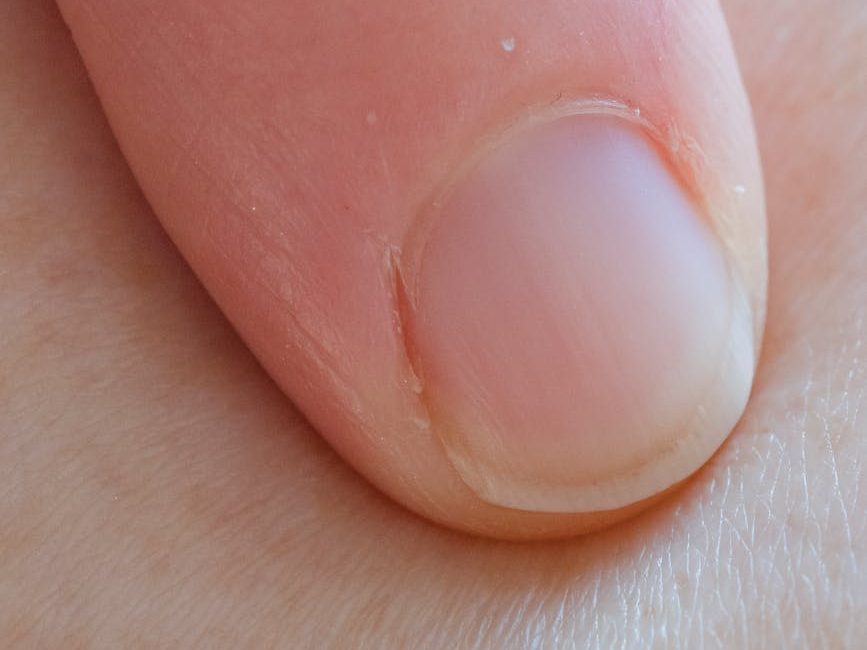 Weird Nail Problems Doctors Say You Shouldn’t Ignore