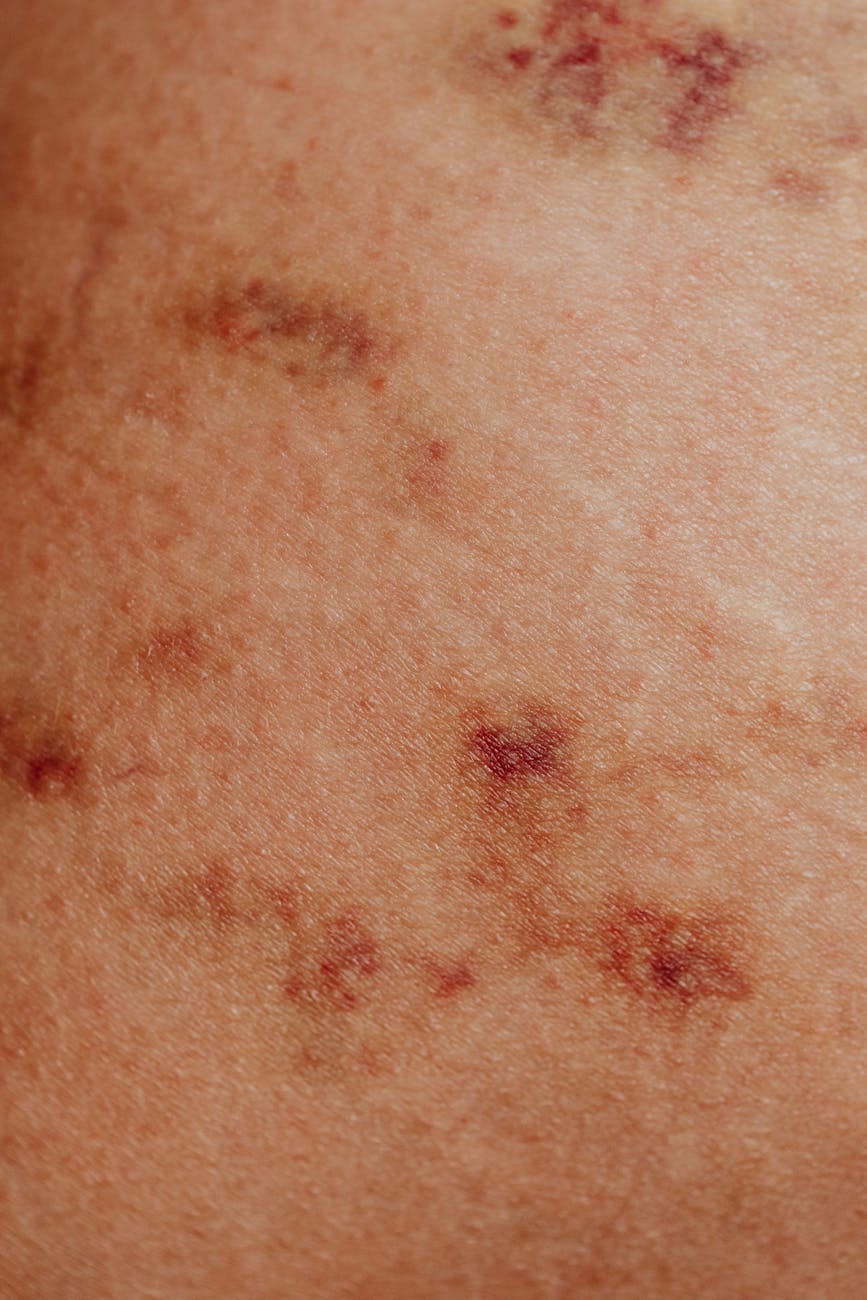 close up of a skin with a disorder