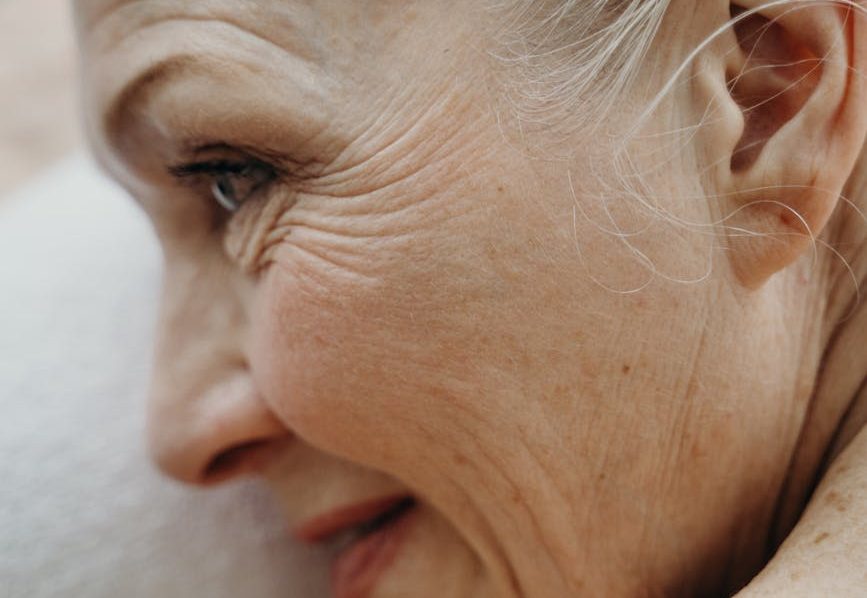 close up photograph of an elderly woman with freckles