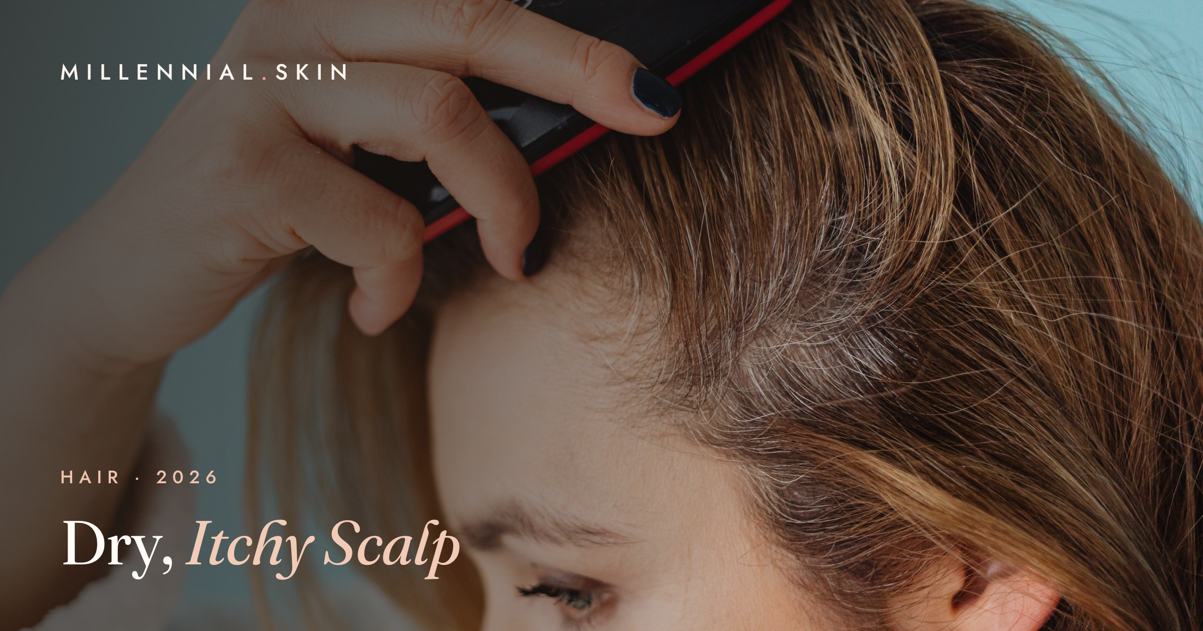 Dry, Itchy Scalp: What Causes It and How to Fix It in 2026