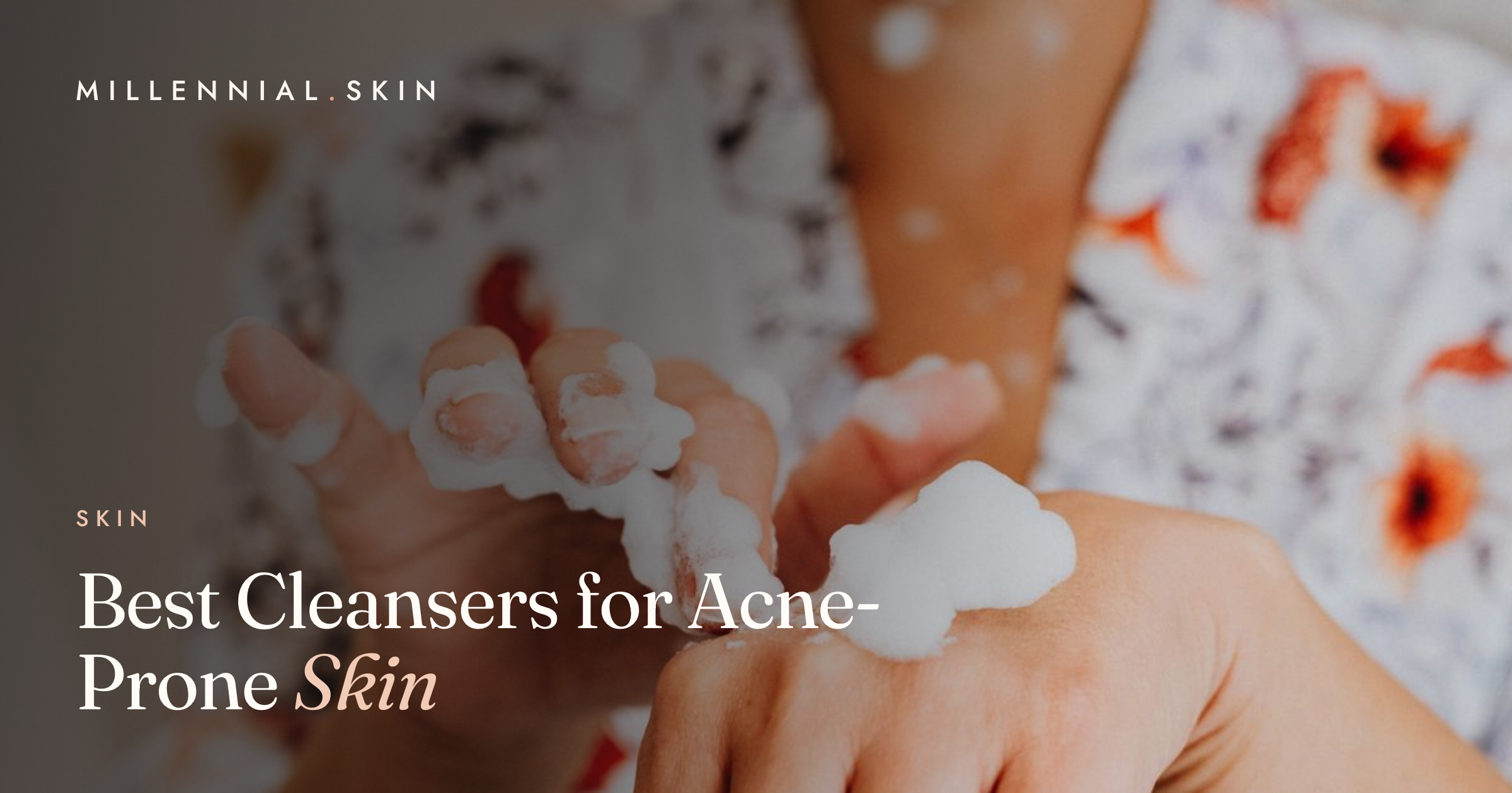 Best Cleansers for Acne-Prone Skin