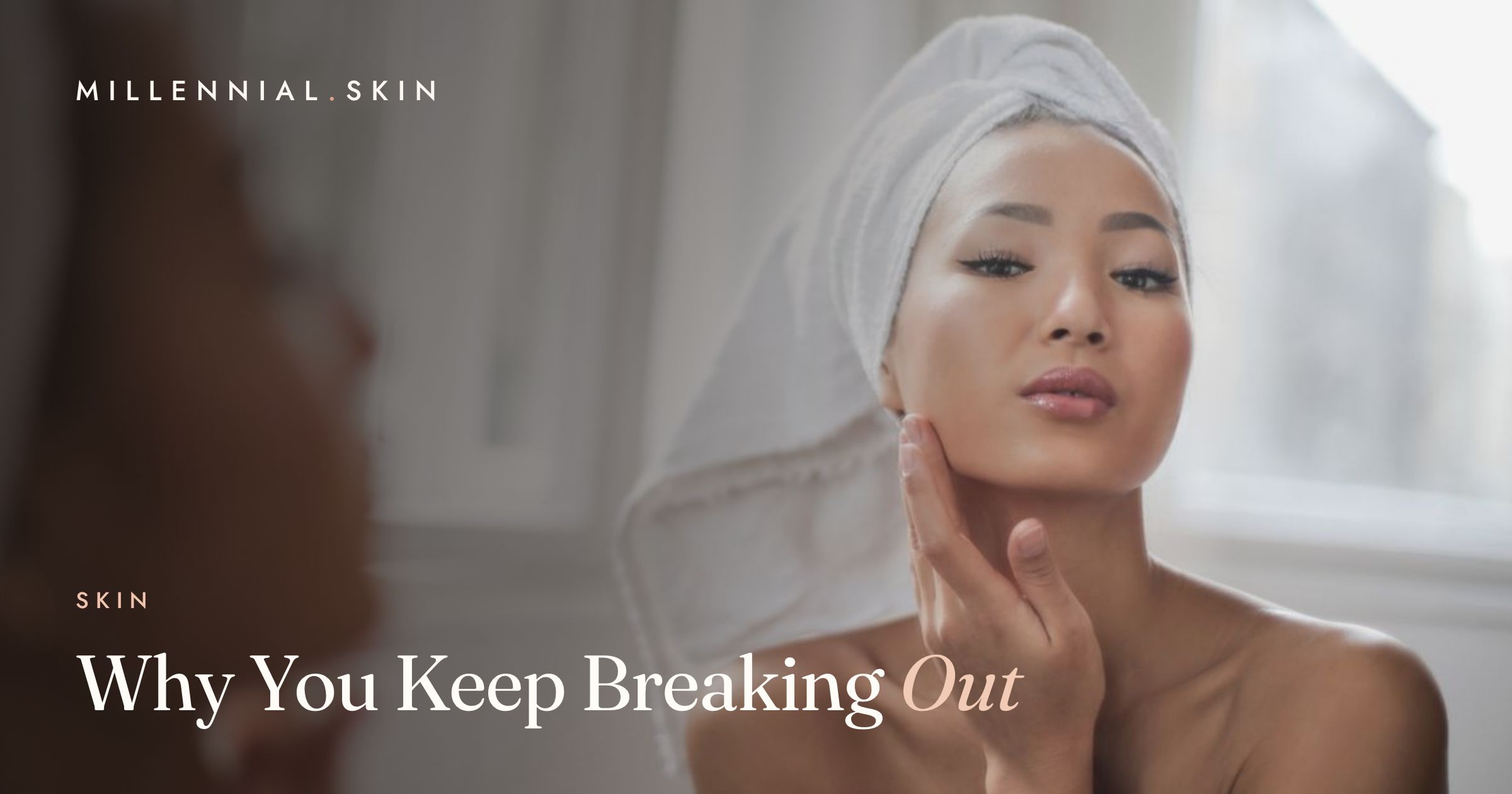 Why You Keep Breaking Out: The Real Causes
